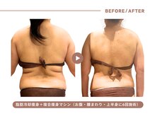 イエス マイサロン(yes My Salon)の雰囲気(【脂肪冷却で徹底痩身】冷やして脂肪細胞ごと減らす最先端技術)