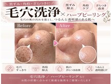 東京オンダリフト 恵比寿店の雰囲気（黒ずみ・角栓・毛穴汚れを集中ケアつるんと毛穴レス肌へ）