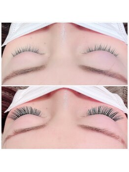 プチブラン(Petit Blanc)/before &nbsp;after