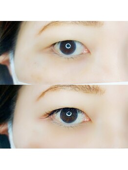 ルピナス 武蔵小金井店(Lupinus)/LEDフラットラッシュ140本