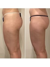 ファビリス 天王寺店(FAVILIS)/オーダーボディ1回/30代