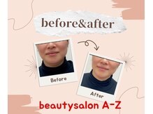 アーズ(A-Z)/マスクをのける準備はできてる？