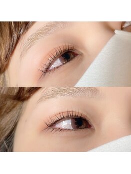 アーティカル(Artical)/#マツパ#Uタイプ