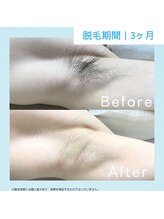 メンズクリア 高知帯屋町店/【メンズクリア】お客様の施術例