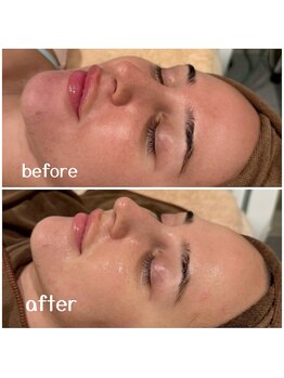 アムールドゥ 麻布十番(Amour deux)/贅沢フルコース4点セット