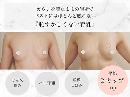 ラーナ(Lana)の写真