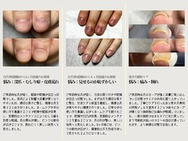 自爪育成のBefore→After