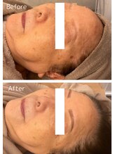 リノ 西宮北口店(Lino)/