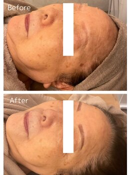 リノ 西宮北口店(Lino)/