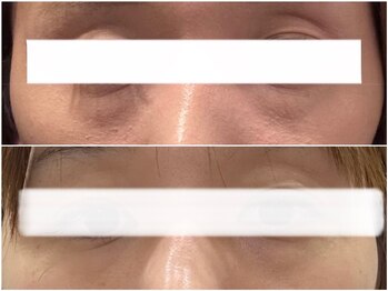 ペリドット(Peridot)/レッドショット×目元マシン