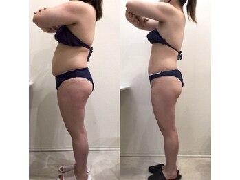 リラパドマ 千葉店(Rela Padma)/激痩せ短期集中ダイエットコース