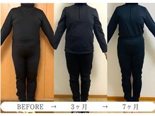 ヨサパーク ノワール(YOSA PARK Noir)/3ヶ月・7ヶ月before/after 2