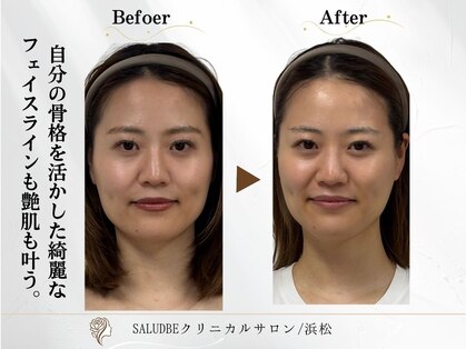 サリューベ(SALUDBE)の写真