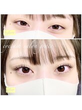 グレイス(grace)/