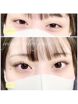 グレイス(grace)/