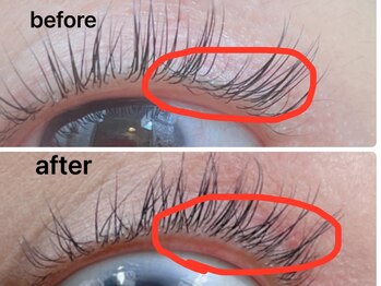 リリー(Lily)/ラッシュアディクトの効果