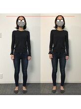 プライベート整体院 アイリー(IRiE)/気になる太もも外張にアプローチ