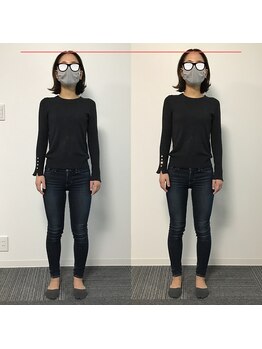 プライベート整体院 アイリー(IRiE)/気になる太もも外張にアプローチ