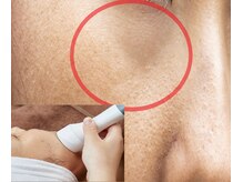 ラグゼ(Beaute Spa LUXE)の雰囲気（影クマ予防！RFでコラーゲン生成◎低高EMSで立毛筋＆表情筋UP）