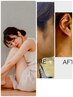 全身&顔脱毛(男性VIO除く.ヒゲ首含む)28,000円→ 14,500円