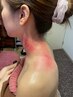 【カッサ】眼精疲労、首肩こり、不眠解消　ショートコース30分（頭、首肩）