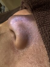 ポア ラボ(Pore Lab)/高知 毛穴洗浄 メンズ専門店