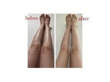 ミル(milu)/強めの圧で脚もすっきり！