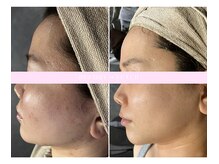 ニコ(nico)/男性にもあったお手入れご提案