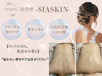 肌管理-SIASKIN-【4/1 NEW OPEN（予定）】の写真