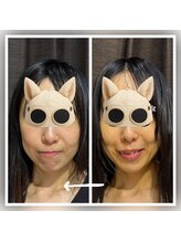 ココスタイルビューティー(COCOSTYLE beauty)/水滴リフティング