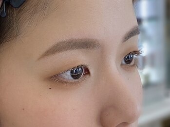 ビューティーガーデン イース/AFTER