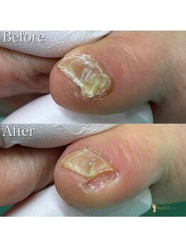 巻き爪補正店 町田店/