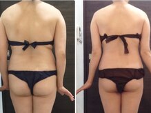 美容整体ウェリナ あま甚目寺院/小顔矯正/骨盤矯正/美脚サロン