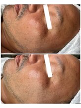 ダチュラ(Da'Chura)/男性もララピールで肌管理★