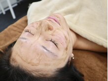 <微細針ハーブピーリング>剥離あり・なし選択OK!ボディも対応◎