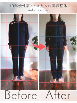 ヨギート(yogate)/リンパマッサージ/小顔ヘッド