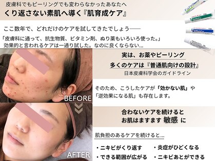 ビアンカの写真