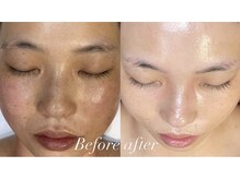 レシェルサロン(Lechelle Salon)/ハーブピーリング　美容成分配合