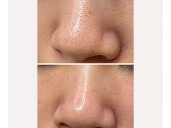 サイ(Sai)/ケアしているのに、改善しない