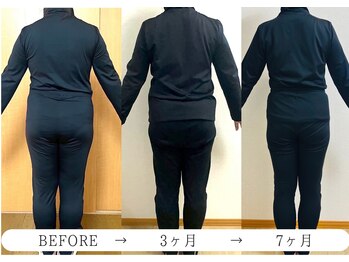 ヨサパーク ノワール(YOSA PARK Noir)/3ヶ月・7ヶ月before/after 3