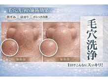 イーラボ 池袋店(e-LABO)の雰囲気（毛穴洗浄◎毛穴の角質、黒ずみ汚れにはこれ一択！定期的に掃除♪）