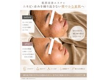 シエル(C i E L.)の雰囲気（最新の肌質改善エステ☆）