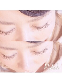 ビューティーホスピタル(Beauty Hospital)/キュートデザイン♪120本