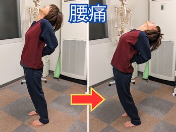 マッチ鍼灸整骨院/腰痛改善ビフォーアフター