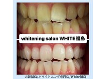 ホワイトニングサロン ホワイト(WHITE)/セルフホワイトニング/大阪/福島