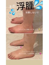 シェリール(CHIRIEUR)/グッバイ浮腫