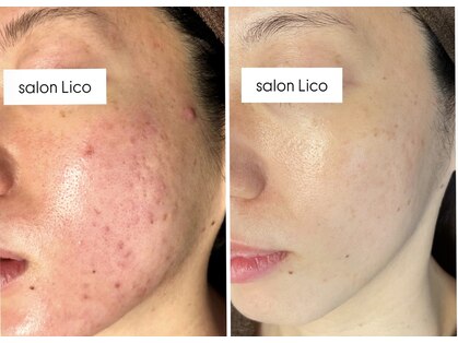 リコ(Lico)の写真