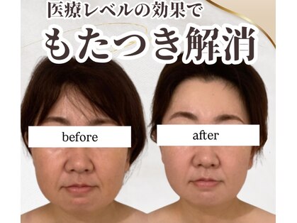 スリーメイ(3mey)の写真