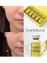 ロゼッティ(ROSETTY)/レモンボトル　小顔