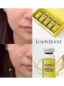 ロゼッティ(ROSETTY)/レモンボトル　小顔